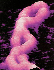 DNA under electron microscope